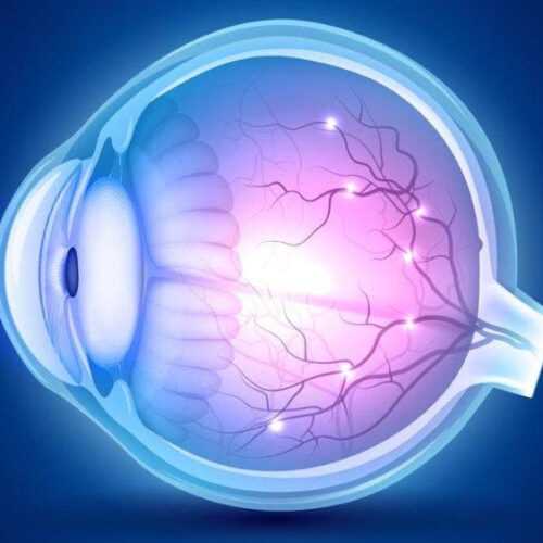 Fenofibrate for Retinopathy