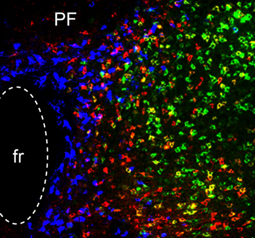 Three distinct brain circuits in the thalamus contribute to Parkinson’s symptoms