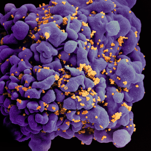 Combination anti-HIV antibody infusions suppress virus for prolonged period