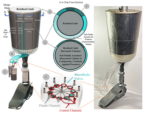 Microfluidic-based soft robotic prosthetics promise relief for diabetic amputees