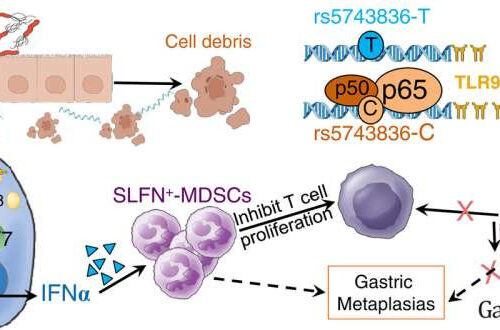 Gene variation may be early indicator for gastric cancer