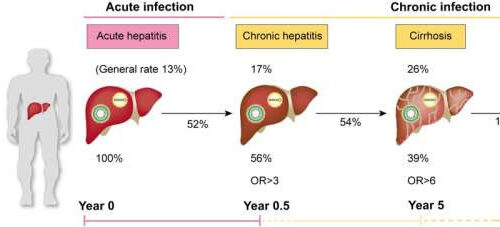 Review shines a light on the overlooked virus, hepatitis D