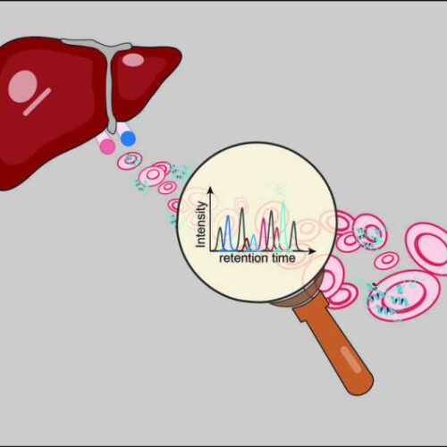 New method for early diagnosis of liver diseases by proteomics