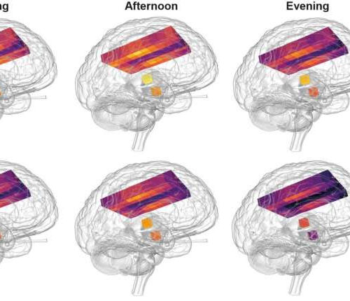 Healthy human brains are hotter than previously thought, exceeding 40 degrees C