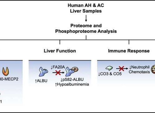 Factors that contribute to alcoholic liver disease