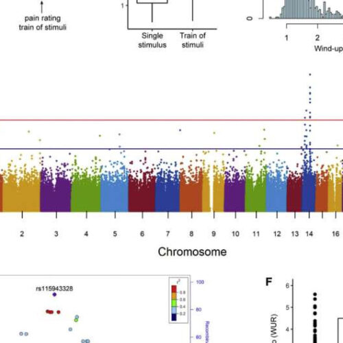 Discovery of gene involved in chronic pain creates new treatment target