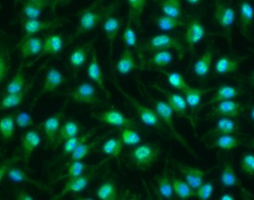 Disclosure of the mechanism that regulates the resolution of inflammation