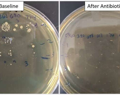 Antibiotics wreak havoc on athletic performance