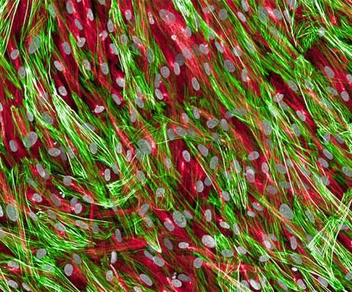 Single-cell map of heart failure suggests possible therapeutic targets