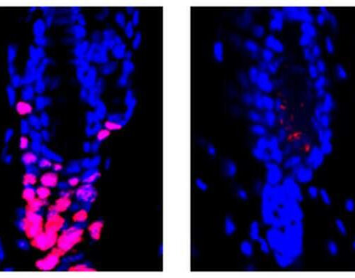 Hair-raising research: Scientists find surprising link between immune system, hair growth