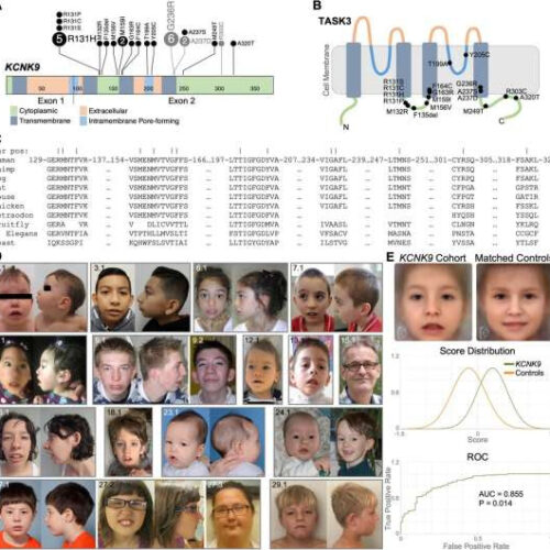 Scientists unravel mystery of rare neurodevelopmental disorder, provide definitive diagnoses to 21 families worldwide