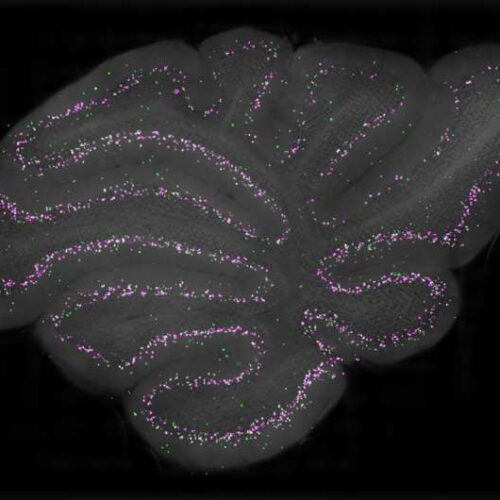 The first detailed characterization of candelabrum cells in the cerebellar cortex