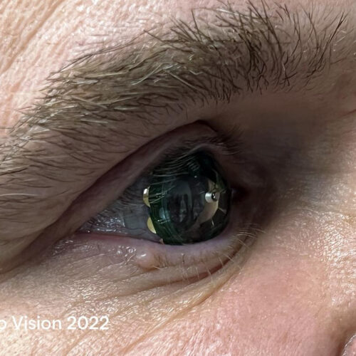 CEO test-drives Mojo Vision’s smart augmented reality contact lens