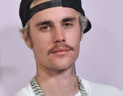 Justin Bieber: what is Ramsay Hunt syndrome, the condition affecting the singer?