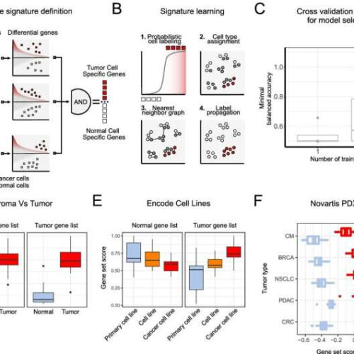 AI identifies cancer cells