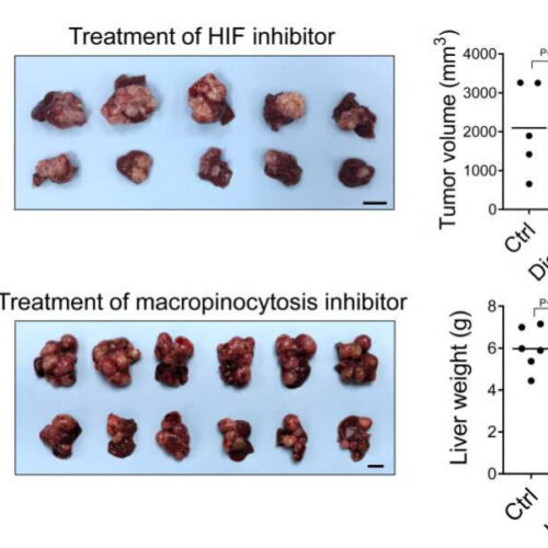 Discovering a new metabolic route for liver cancer and paving the way for new therapeutic opportunities