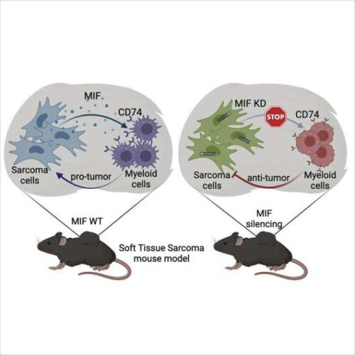 How tumors make immune cells ‘go bad’