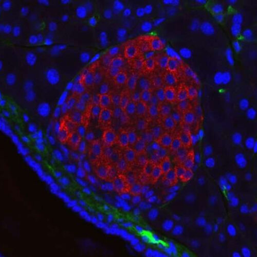 Researchers develop pancreatic beta-cell restoring therapy for treating type 1 diabetes