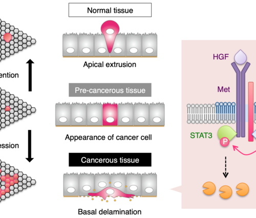 Breakthrough in study of how epithelial cells become cancerous