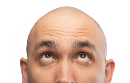 Hair growth genetic trigger discovered that may cure baldness