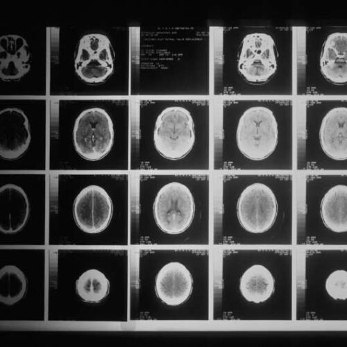 Similar patterns of brain activation and language selectivity found in speakers of 45 different languages