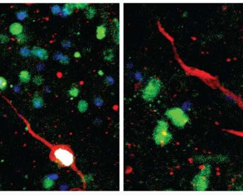 Discovery of molecular signatures of immature neurons in human brain provides new insights into brain plasticity