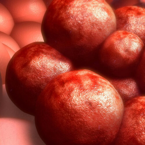 Scientists identify potential “weak spot” in drug-resistant cancers