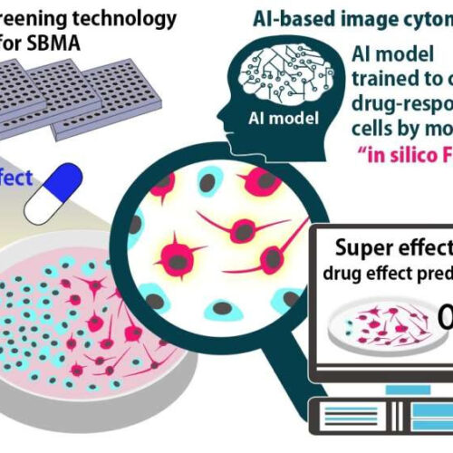 AI analyzes neuron changes to detect whether drugs are effective for neurodegenerative disease patients