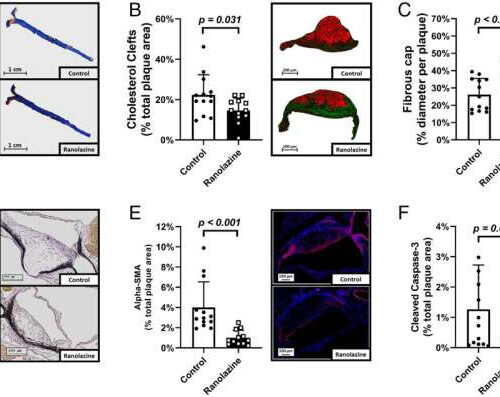 Established drug for symptoms of angina pectoris also protects vascular system