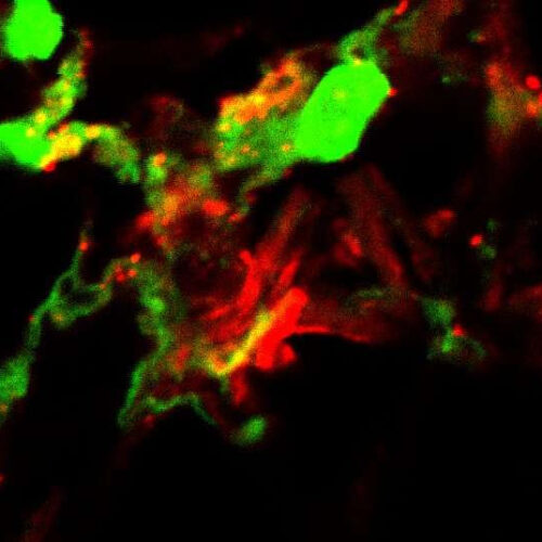 Study reveals new mode of triggering immune responses