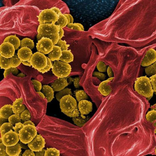 New understanding of ‘superantigens’ could lead to improved staph infection treatments