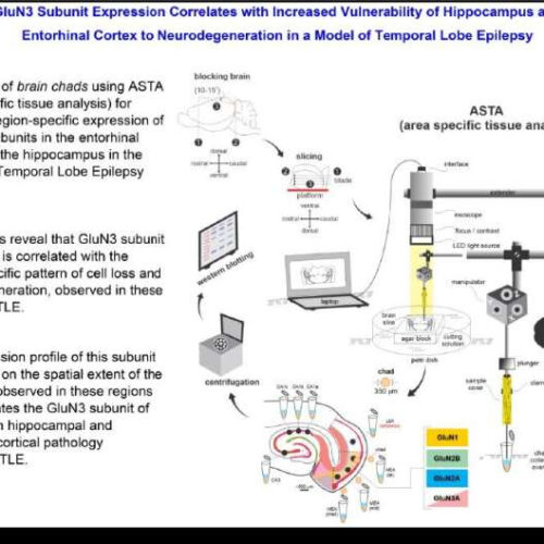 Link between specific brain protein and vulnerability to temporal lobe epilepsy neurodegeneration discovered