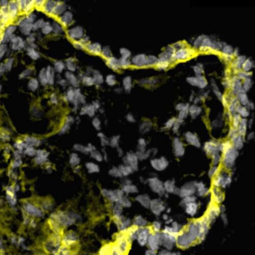 Scientists use mini-kidney models to identify potential drugs for polycystic kidney disease