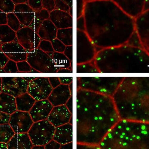 Study finds loss of ‘youth’ protein may drive aging in eye