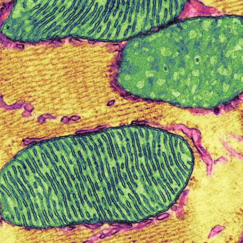 How mitochondrial damage ignites the ‘auto-inflammatory fire’