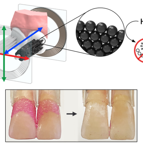 Shapeshifting microrobots can brush and floss teeth