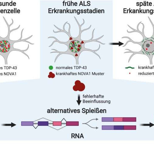 ALS: Early disease mechanisms discovered