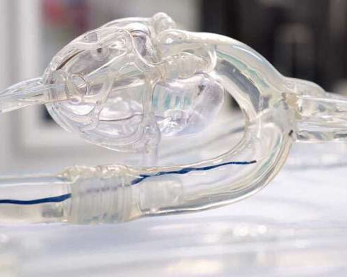 A magnetically steerable catheter for quick and safe stroke treatment