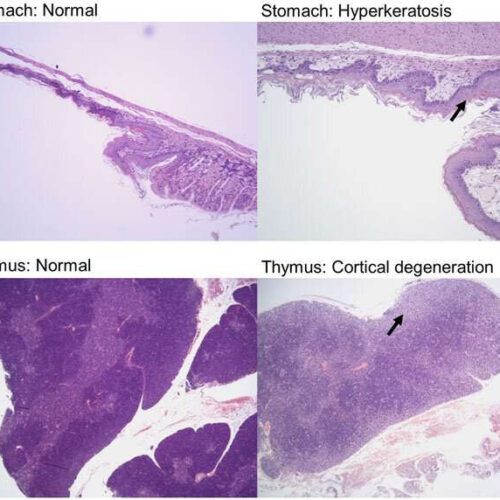 Researchers test drug combination as means to prevent drug resistance in cancer cells