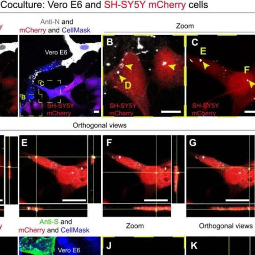 Study suggests SARS-CoV-2 virus enters the brain by using cells in the nose to make nanotube tunnels