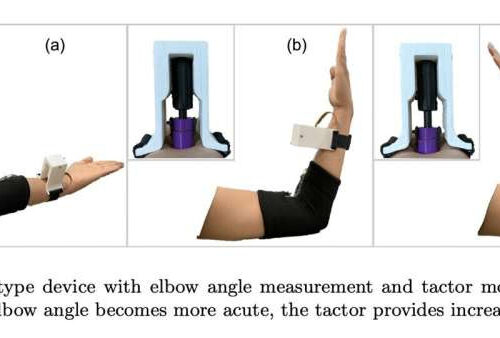 A wearable device to assist individuals with the rare genetic condition PIEZO2-LOF