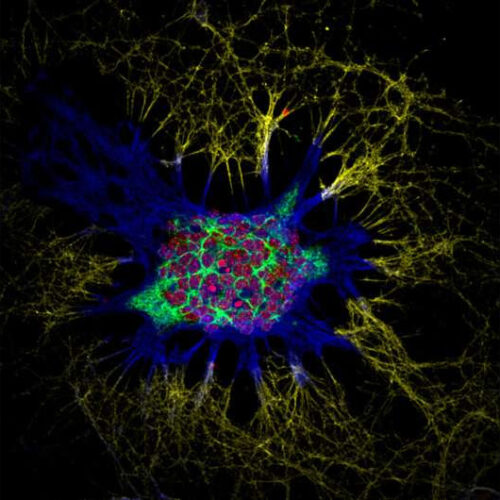 Neuronal circuit serving social interaction