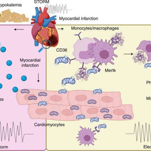 Two different white blood cell types play opposing roles in affecting heartbeat irregularities after heart attack