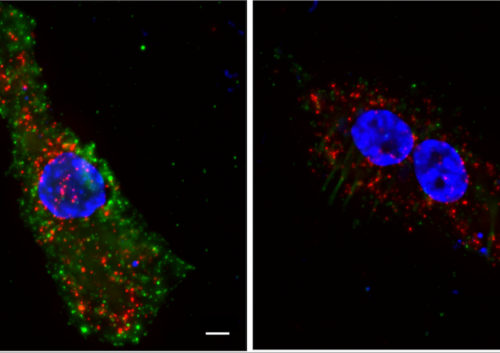 Immune system uses two-step verification to defend against HIV