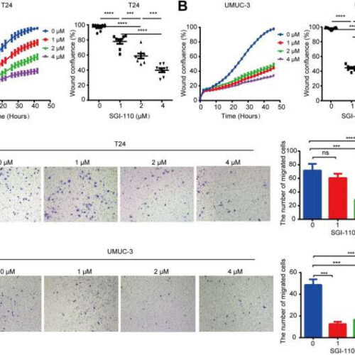 DNA methylation subtype classification can predict outcomes of urothelial carcinoma