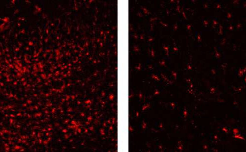 Researchers identify cells that cause neuronal death in a mitochondrial disease animal model