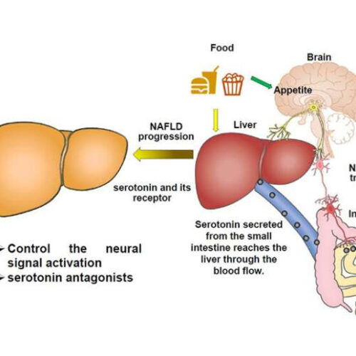 Involvement of the liver–gut peripheral neural axis in nonalcoholic fatty liver disease pathologies via hepatic HTR2A