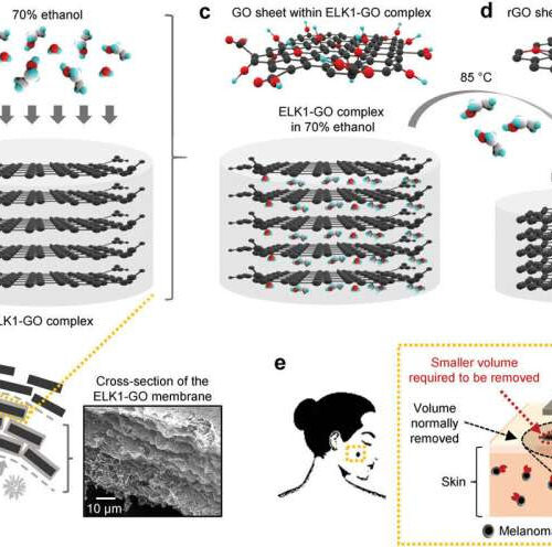 New material for surgical dressings shown to prevent recurrence of melanoma and enhance healing