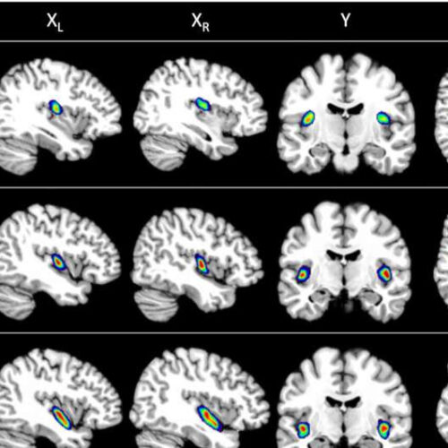 Researchers identify seven new areas in the insular cortex