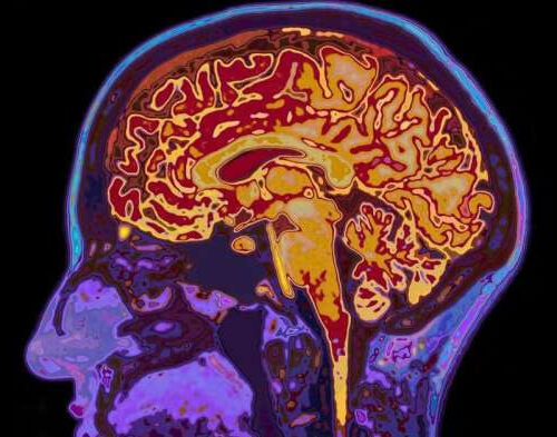 ‘Brain fingerprinting’ of adolescents might be able to predict mental health problems down the line